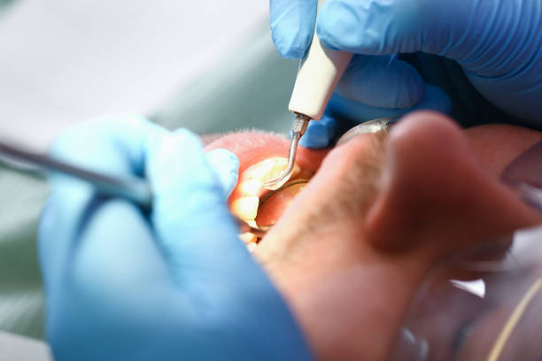 Best Emergency Tooth Extraction in Ampere North, NJ