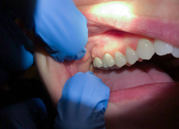 Best Same-Day Emergency Dental Services in Ampere North, NJ