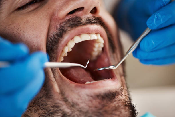 Best Same-Day Emergency Dental Services in Ampere North, NJ